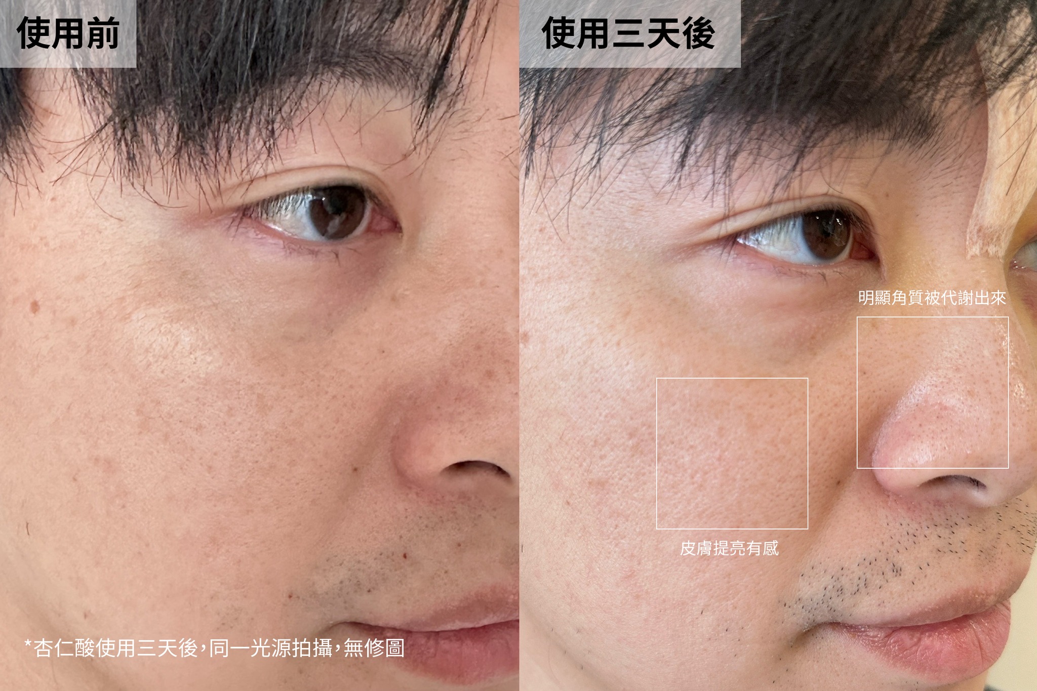 洋洋推薦杏仁酸-單瓶