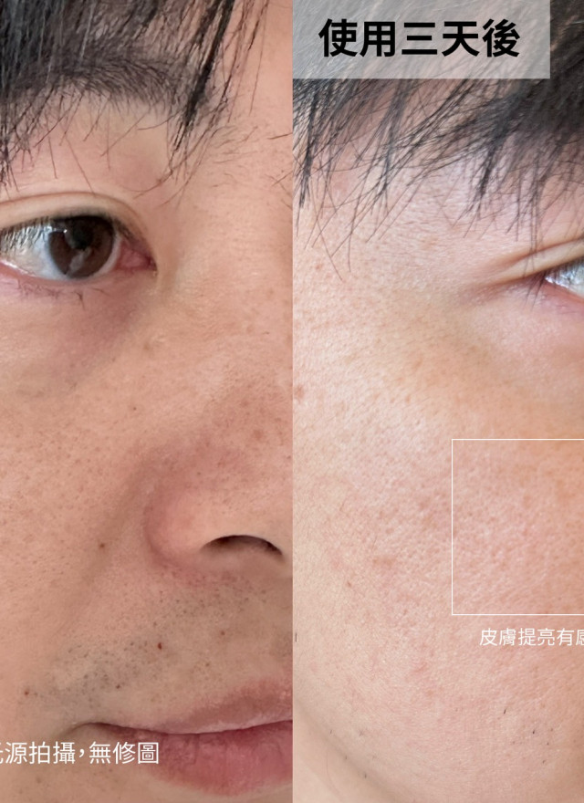 洋洋推薦杏仁酸-單瓶